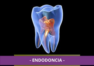 servicio-endodoncia